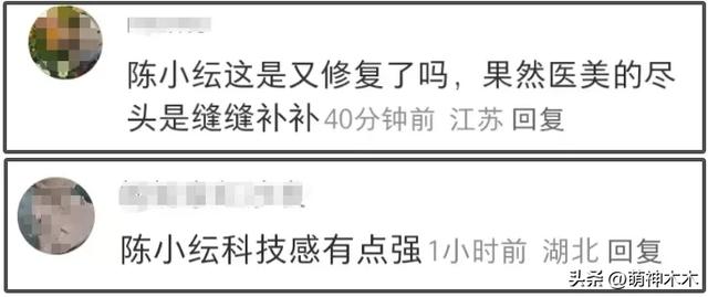 央视高清镜头下的女明星，整容脸和原生脸差别大，一眼就看出痕迹-15.jpg